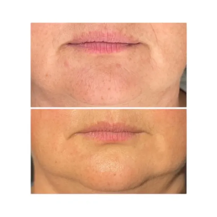 Крем ультра разглаживающий корректор морщин Alphascience Surface [CR]